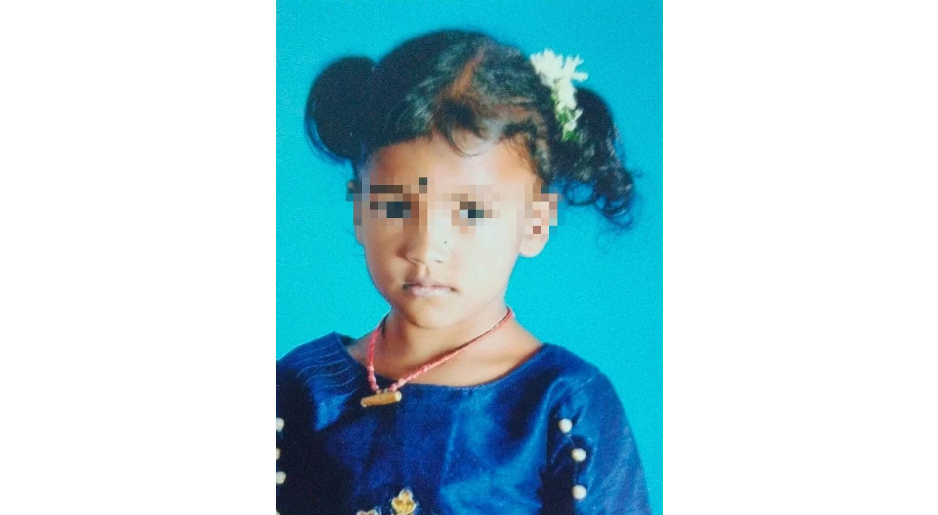 Donate for Roshini’s Treatment
