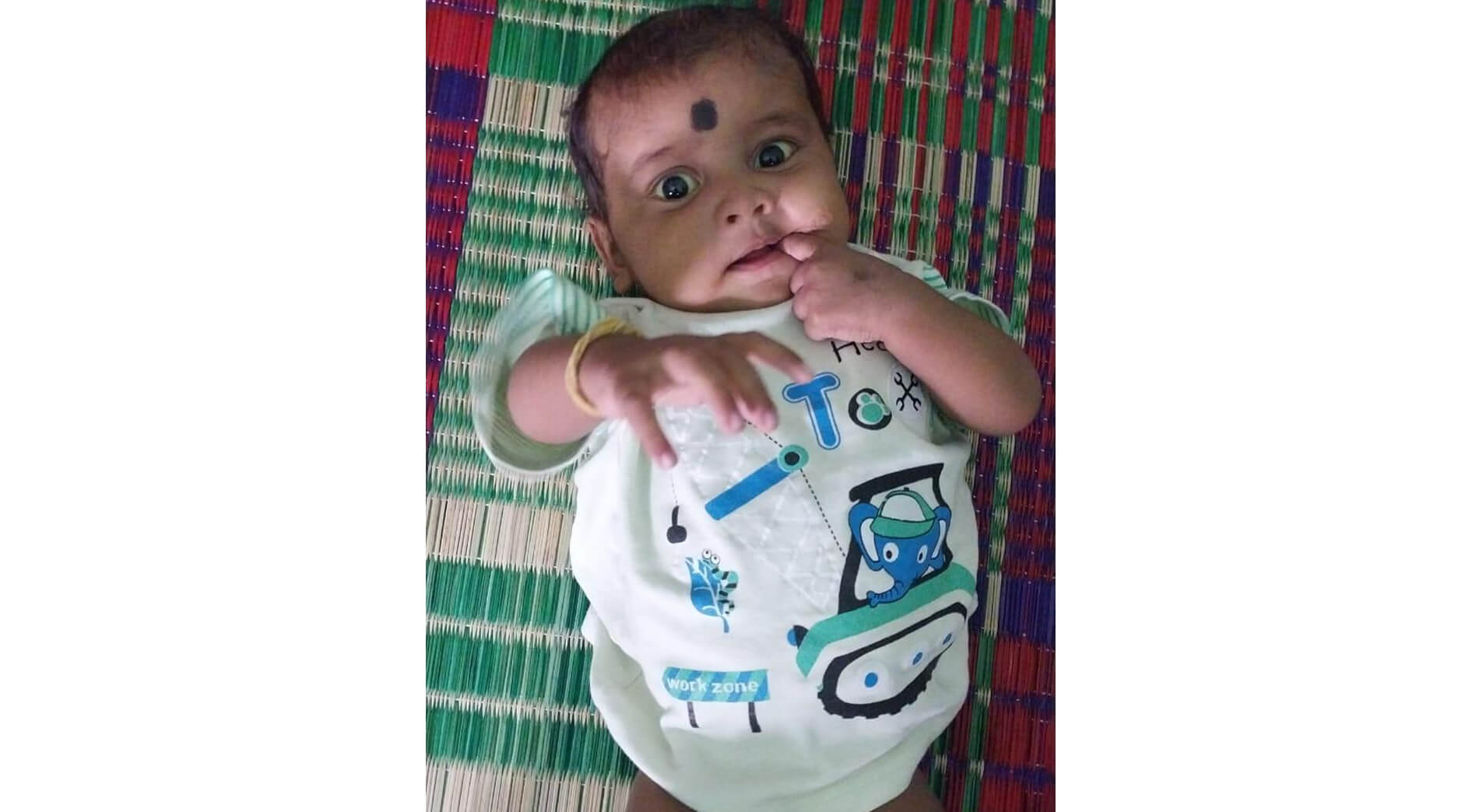 Donate for Baby’s Treatment