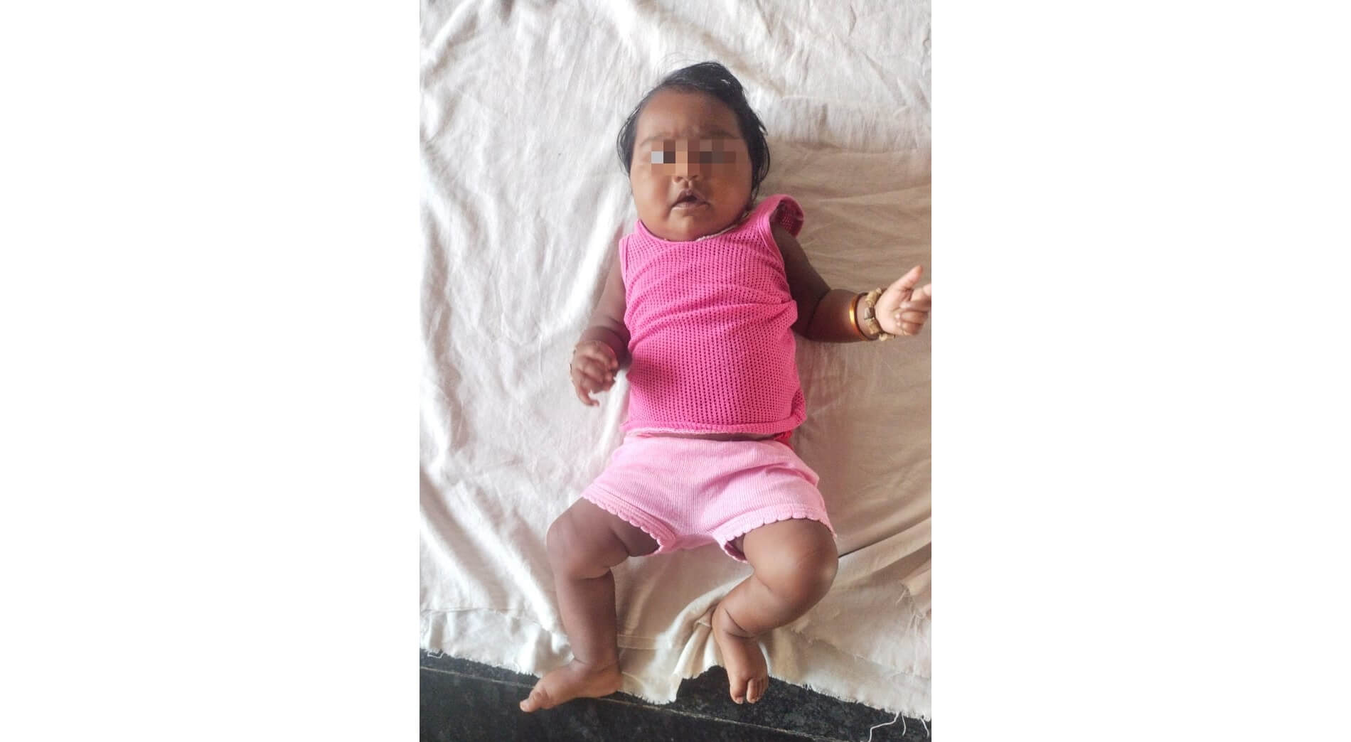 Donate for Baby’s Treatment