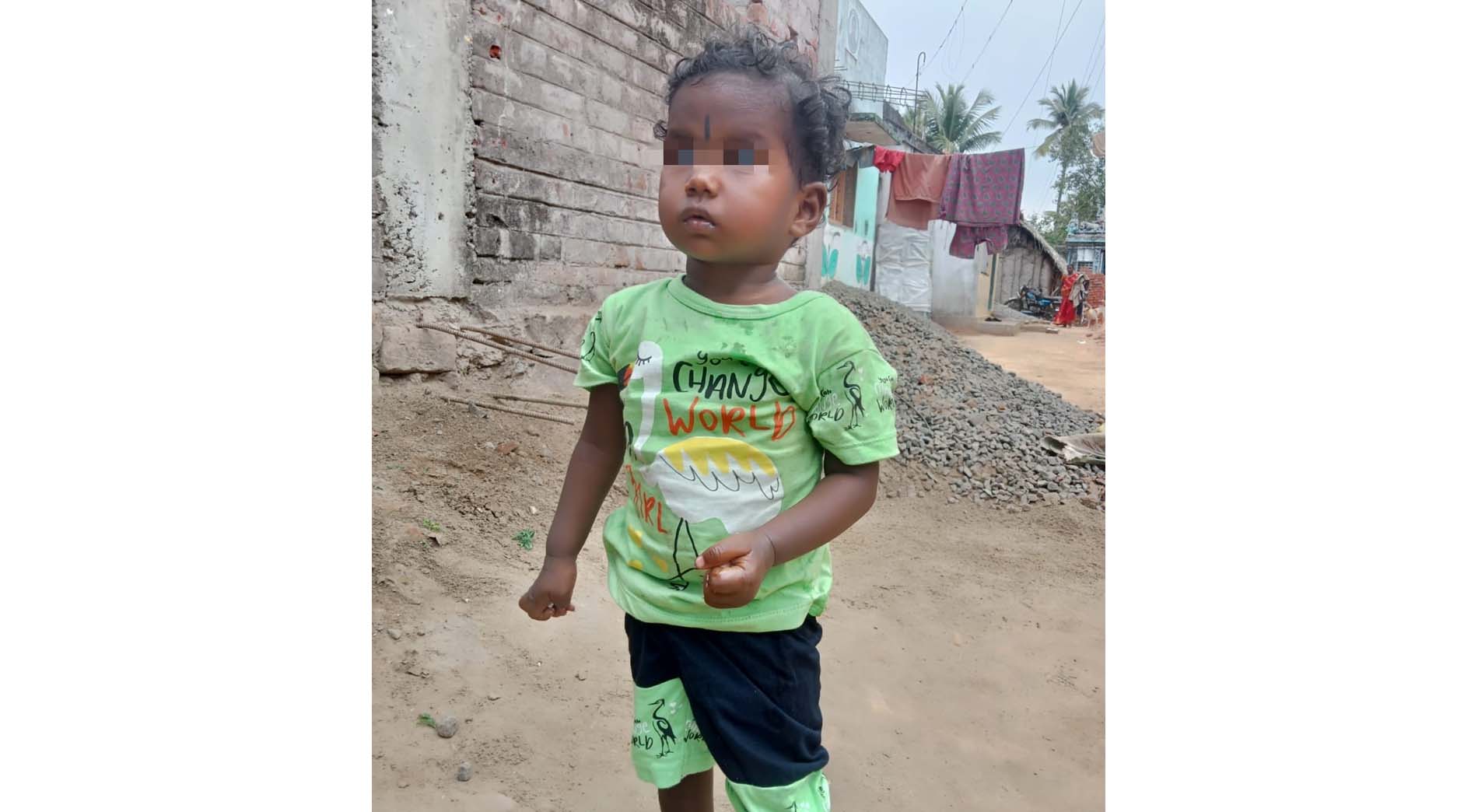 Donate for Baby’s Treatment