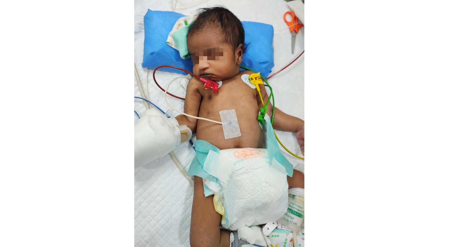 I am Sandhya, raising funds for my daughter who is 19 days old.