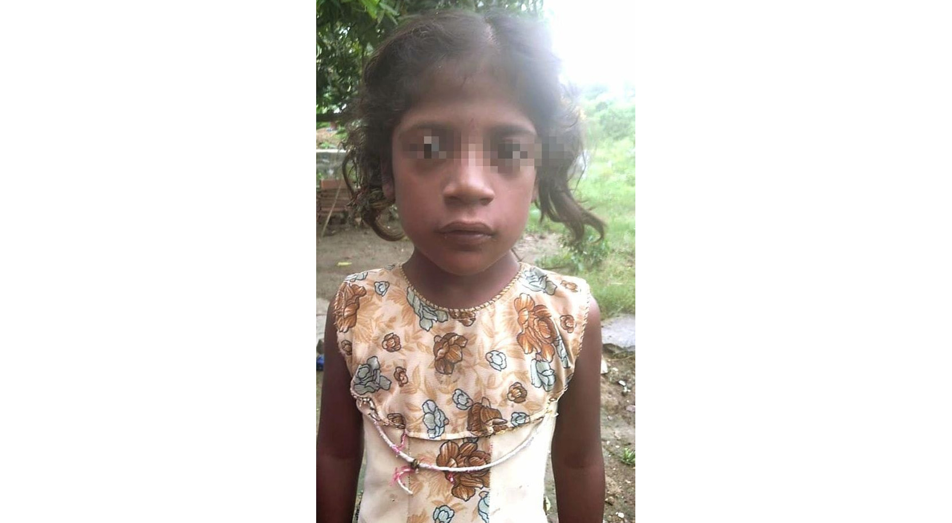I’m Revathi raising fund for my 6 year old child, Subithra.