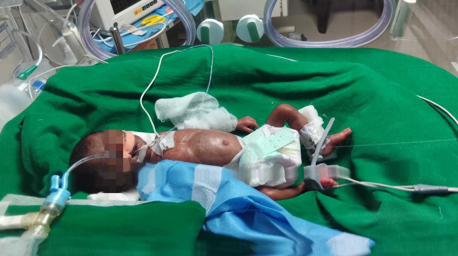 I’m Priyanga raising fund for my female Baby.