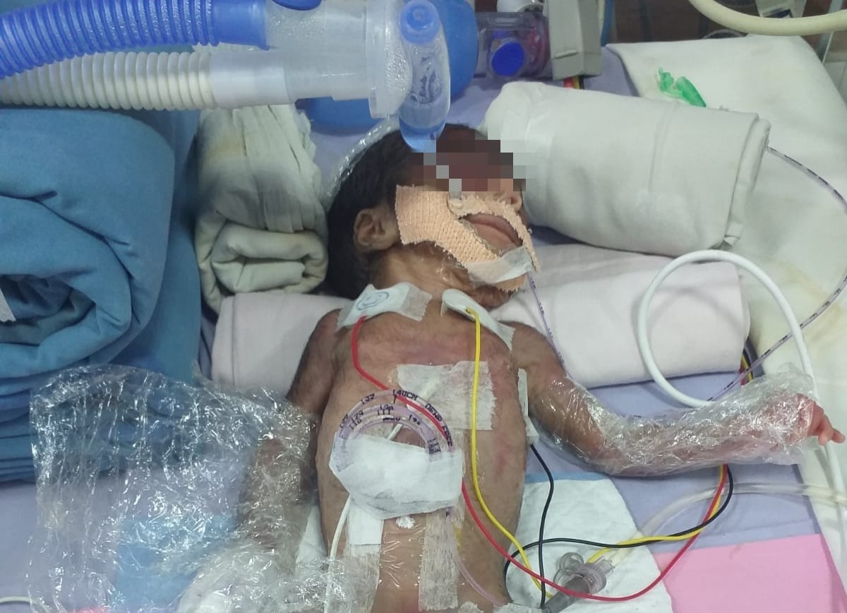 Urgent Help Needed for Our Newborn Baby