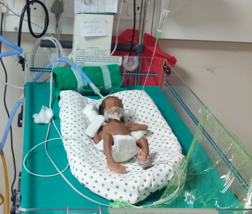 I’m Niraimadhi raising fund for my male Baby