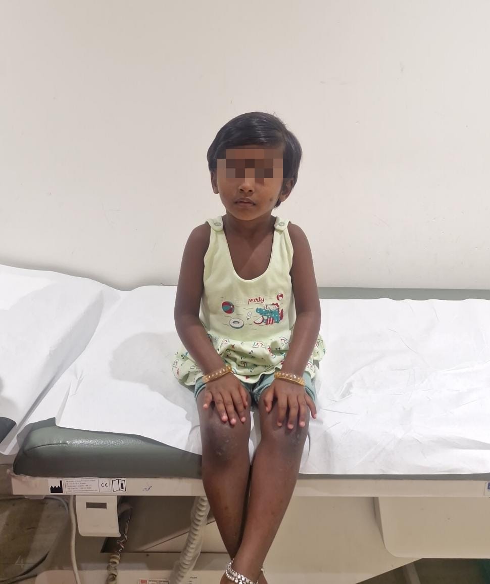 Help Save Little Pranavi’s Life