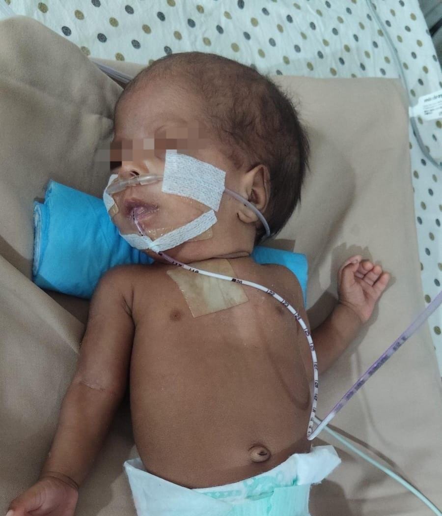 Help 2-Month-Old Baby Fight for Life