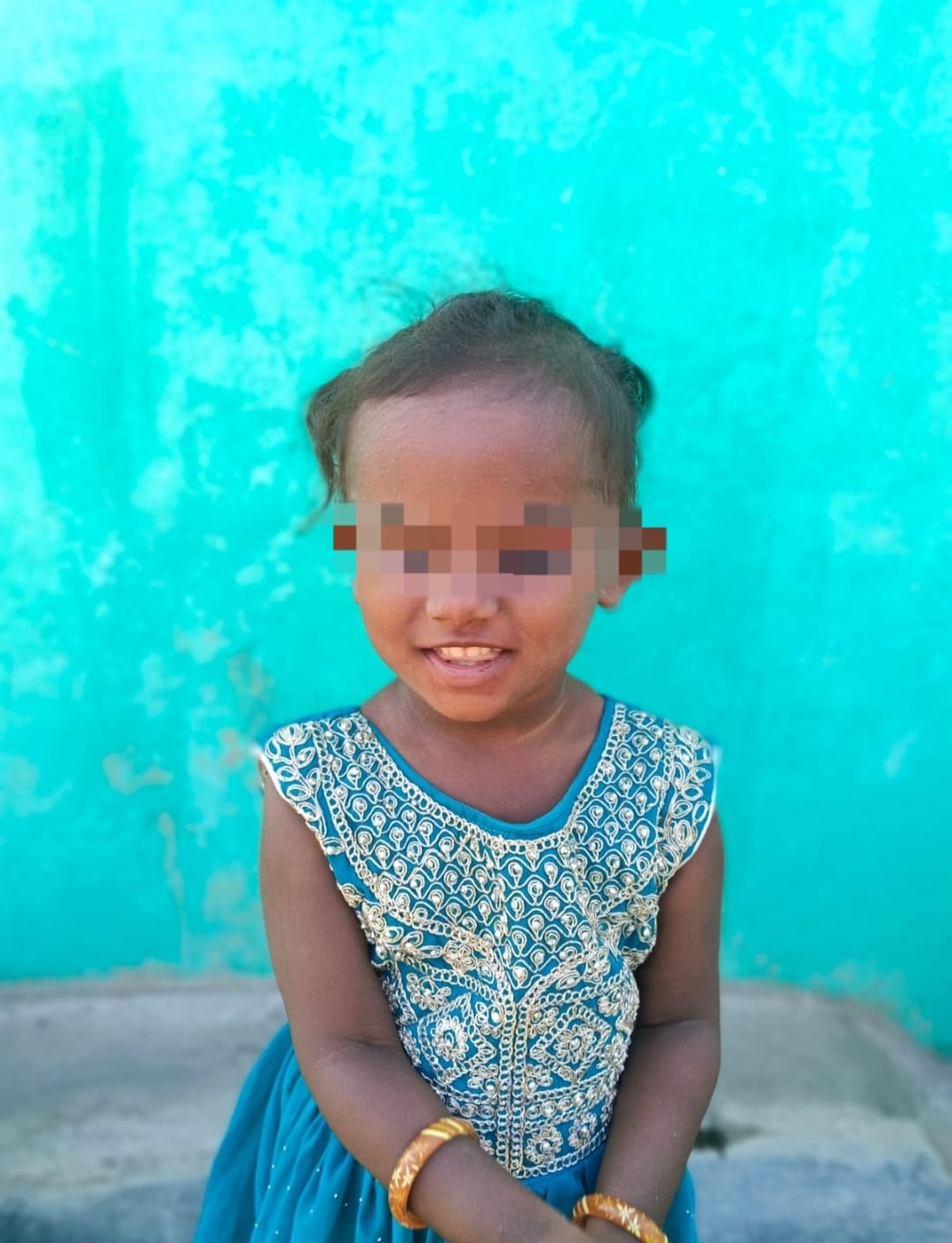 Help Nethra’s Heart Treatment